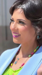 الفنانة نورهان تعود لنشاطها الفني بعد حادث إصابتها بيدها